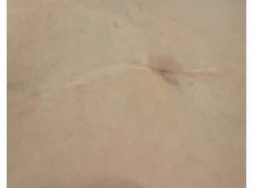 DS on and off stomach pain, could it be appendix?