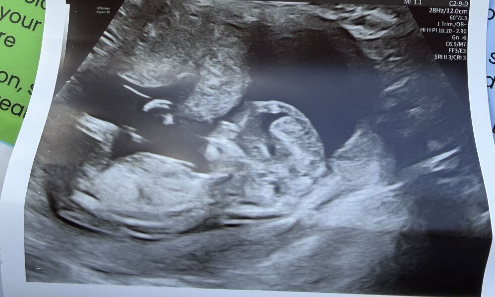 Pregnancy aversions and cravings