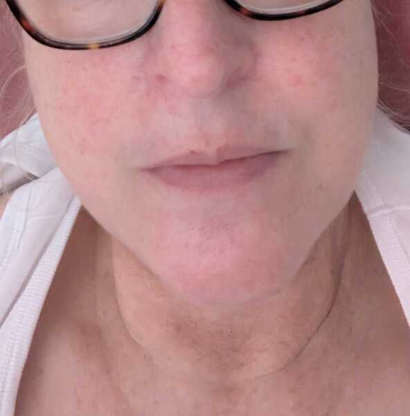 This is what normal skin of a 30+ woman looks like without makeup!
