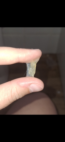 *TMI* what cervical mucus is this?