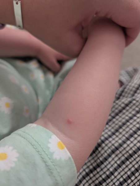 What are these spots on my two year old's arms?
