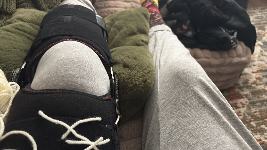 Knee dislocation & recovery