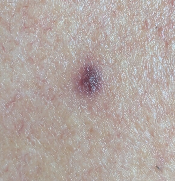 What could this be, and should I be worried about it?