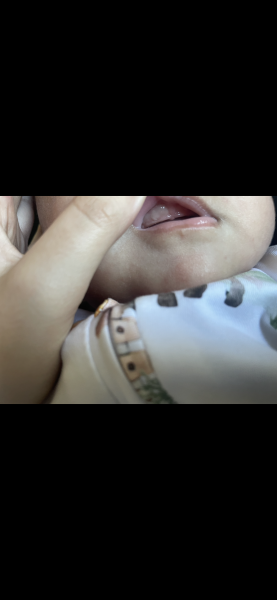 Could this be teething in my baby?