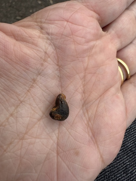 Ear wax lump from hell
