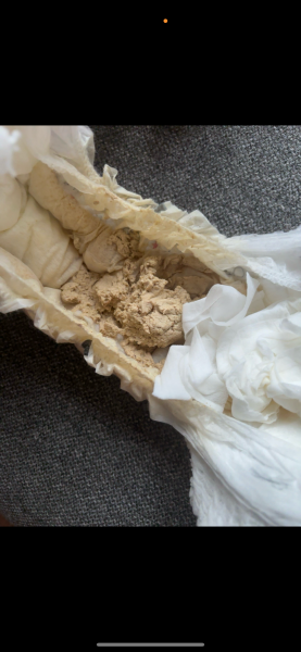 Would you be concerned about this unusual nappy poo colour? *[pic included]