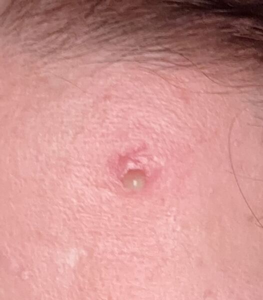 Pus from Spot- WTF