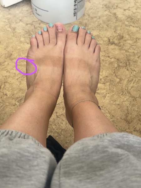 Does my foot look swollen ?