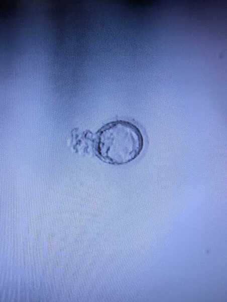 42 and starting IVF treatment tomorrow - would love some company for the journey ☺️
