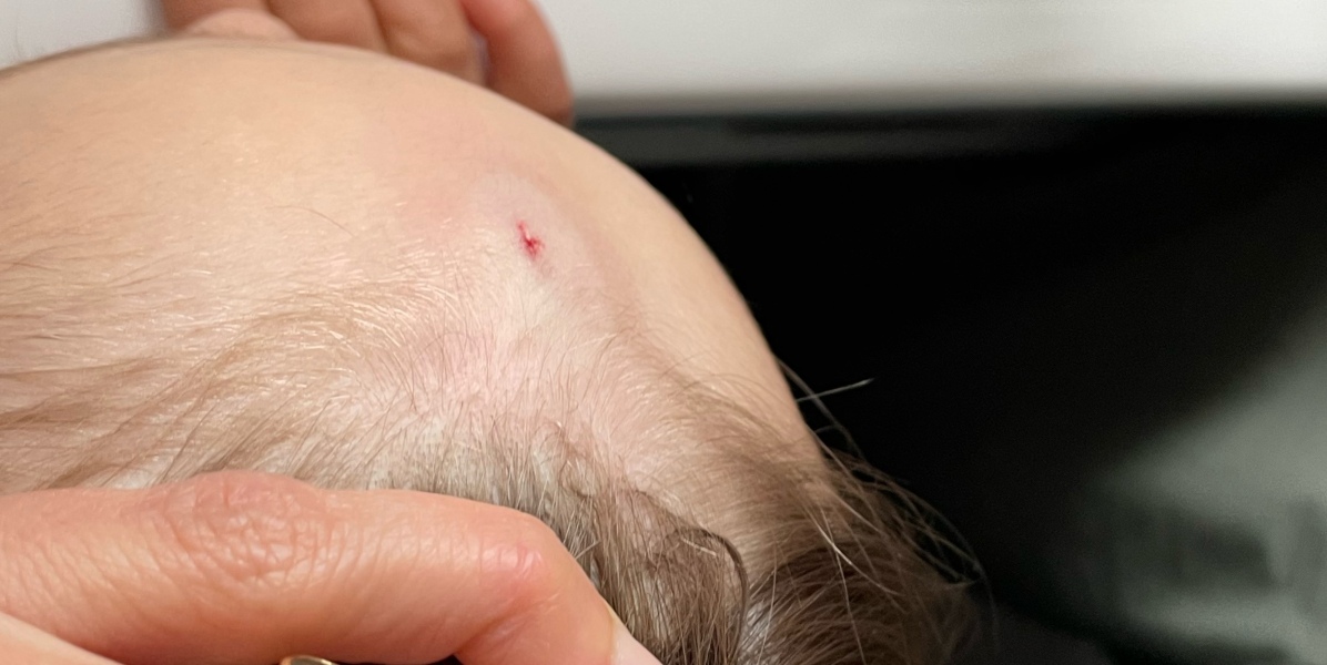 Will this leave a dent?