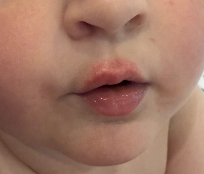 Any ideas what this is on my son’s face…