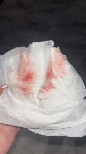 Help 😢 5 weeks 4 days pregnant, light pink blood. Image included.