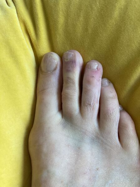 Is it broken ? (Pic)