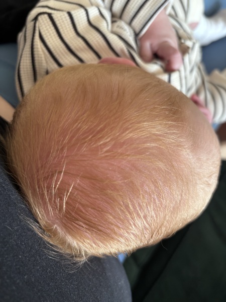 Will baby be a red head or too early to tell?