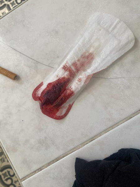 Bleeding at 7 weeks