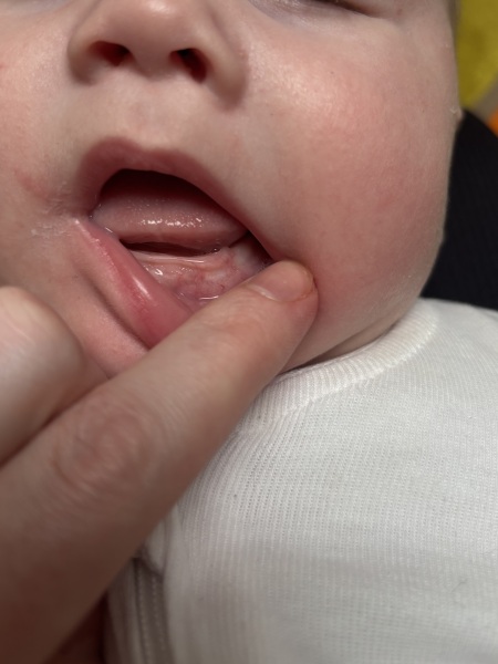 Could my 13 week old be teething and causing bottle fussiness?