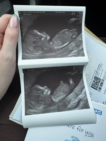 Gender predictions 12 week scan?