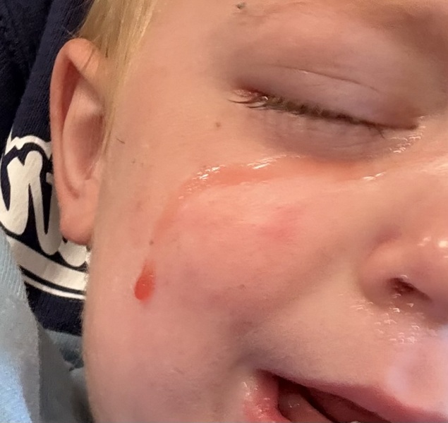 19 month old, does anyone know what this is I’m so worried