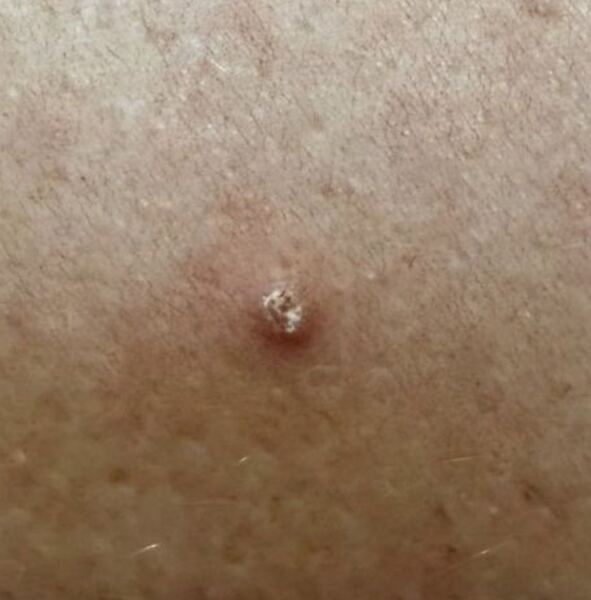 Spot or not?