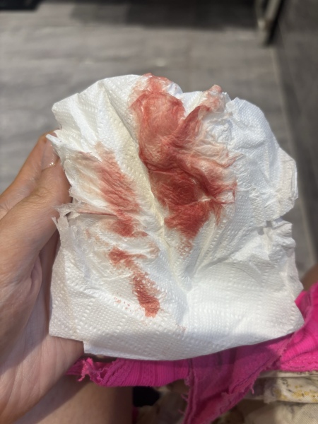 Help 😢 5 weeks 4 days pregnant, light pink blood. Image included.