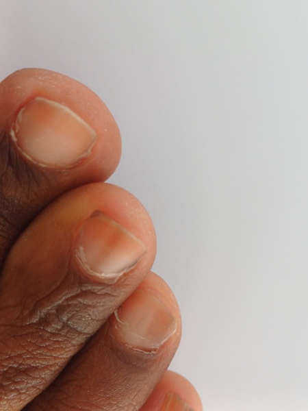 Terry's nails