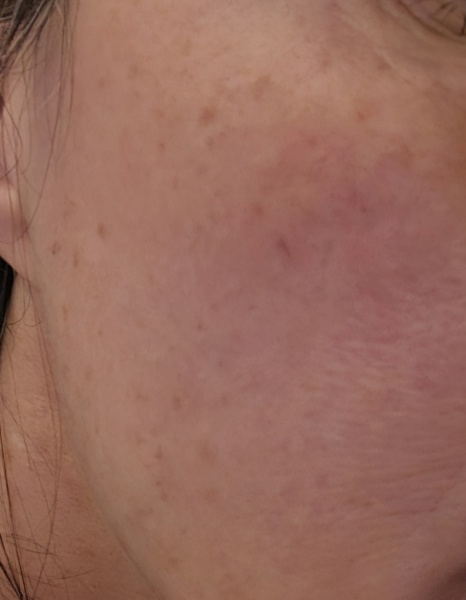 This is what normal skin of a 30+ woman looks like without makeup!