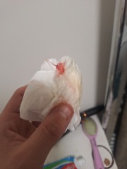 Could this be my mucus plug at 37 weeks pregnant?