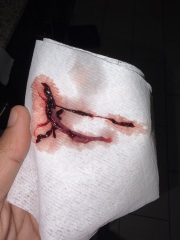 I think I may have had a miscarriage but am unsure [GRAPHIC PHOTOS ATTACHED]