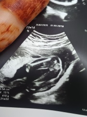 Ladies who have had a gender scan around 16 weeks 