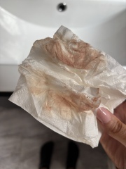 Help 😢 5 weeks 4 days pregnant, light pink blood. Image included.