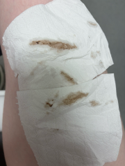 5 weeks with spotting and cramping