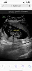 Boy or girl guesses?