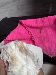 brown spotting when wiping, please help