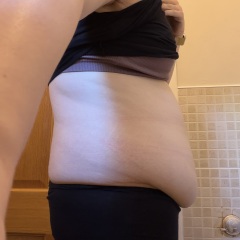 Will my apron belly improve with further weight loss and exercise