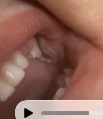 19 month old, does anyone know what this is I’m so worried