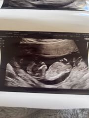 Girl or boy? 🩵🩷