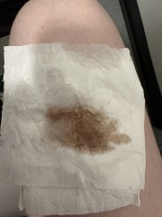 5 weeks with spotting and cramping