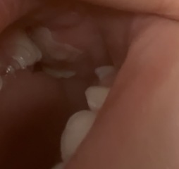 19 month old, does anyone know what this is I’m so worried