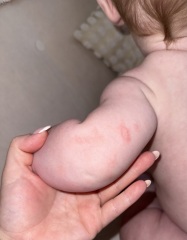 Thoughts on what this could be on 6mo son and should I get it looked at today?