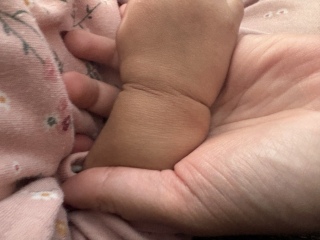 What could cause this mark on my daughter’s wrist?