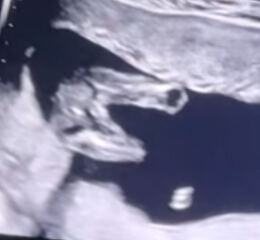 Girl or boy ?