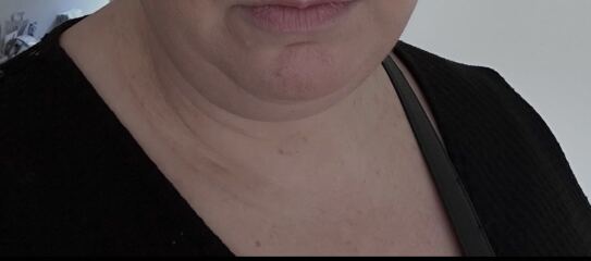 Mounjaro/Wegovy with >5 stone/30kg to lose - thread 12!
