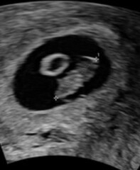 Confused by scans