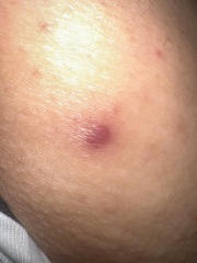 Pictures in comments
