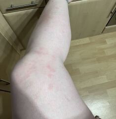 What has feasted on me?!