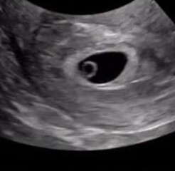 Confused by scans