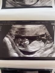 Girl or boy? 🩵🩷