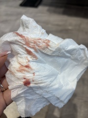 brown spotting when wiping, please help