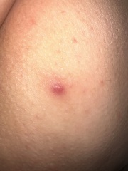 Pictures in comments