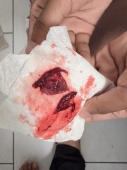 I think I may have had a miscarriage but am unsure [GRAPHIC PHOTOS ATTACHED]